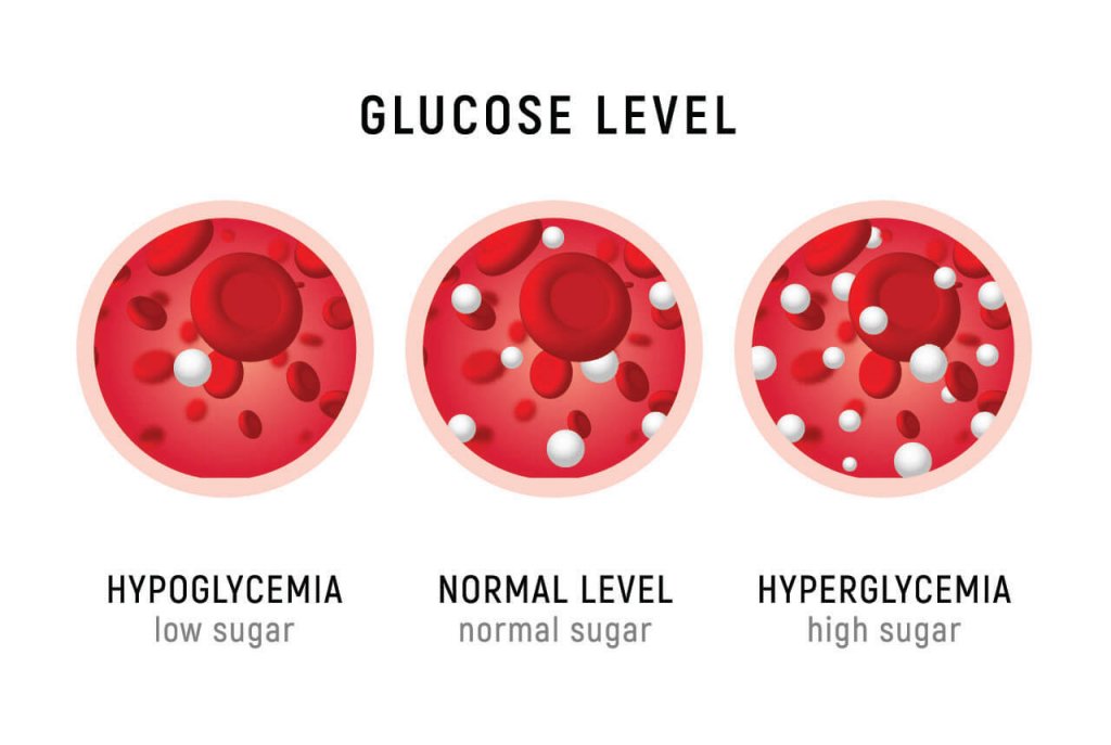 An image showing low, normal and high blood sugar
